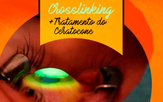 especialidade-clinica-de-olhos-cidade-nov-2020