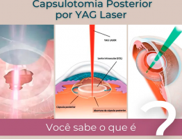Capsulotomia Posterior por YAG Laser
