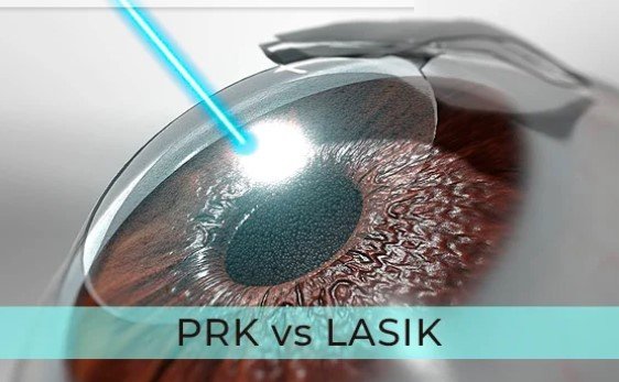 PRK