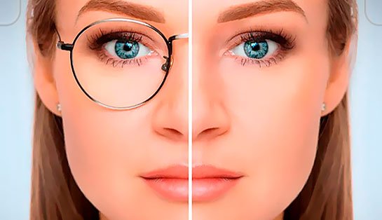 Montagem de antes e depois de cirurgia refrativa. Rosto de uma mulher dividido ao meio: do lado esquerdo ela usa óculos de grau e do lado direito aparece sem óculos com o olhar nítido, ilustrando a correção de miopia e astigmatismo na Clínica de Olhos da Cidade em Botafogo.