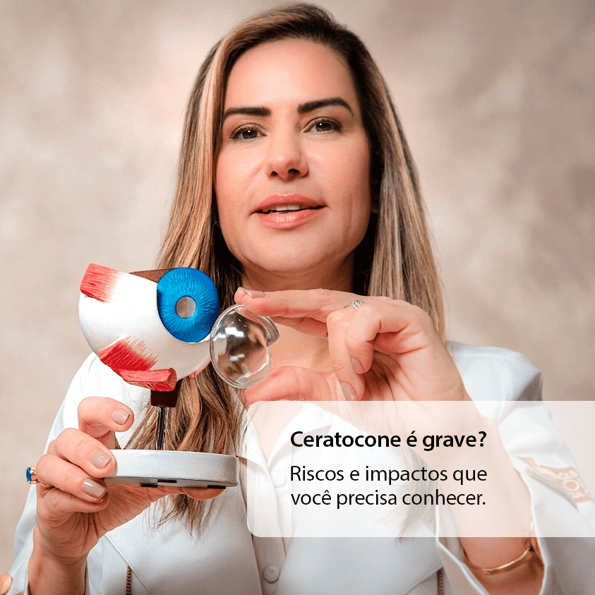 Dra. Andressa Guimarães, especialista em ceratocone em Botafogo, Rio de Janeiro, segurando um modelo anatômico de olho humano e destacando a curvatura da córnea. Em destaque, o texto do banner: Ceratocone é grave? Riscos e impactos que você precisa conhecer.